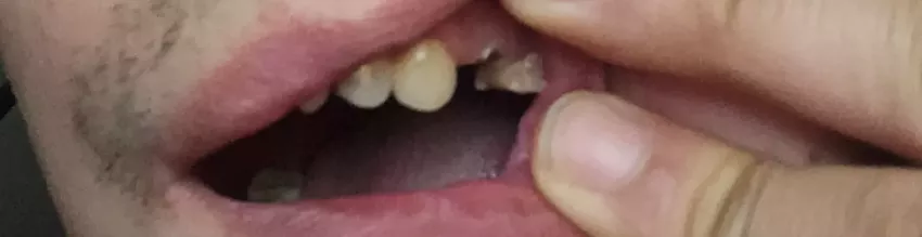d140d9304419937b4f6d6655439fa93d_1744821981_889.webp