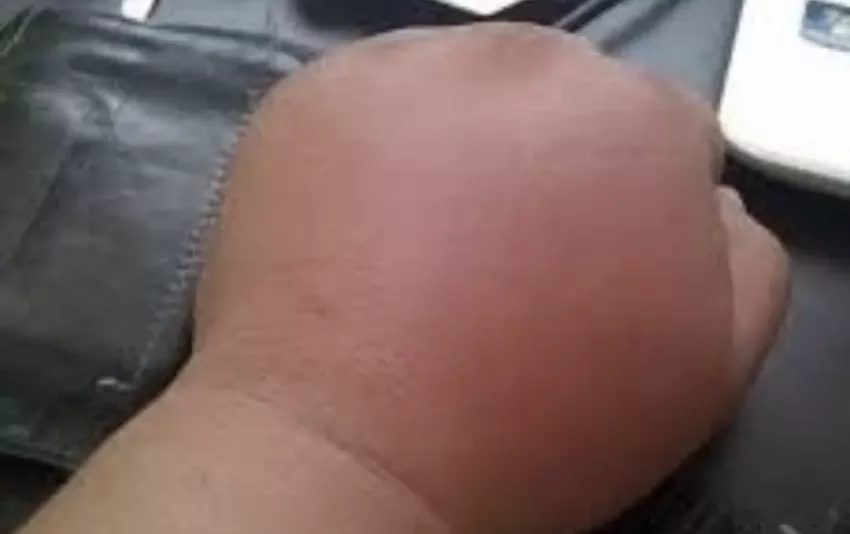 a9841c2e261691e02867d2d5a55a5846_1776829014_172.webp